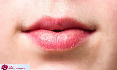 Сухость губ и шелушение: ТОП лечебных средств, правила ухода и мер профилактики