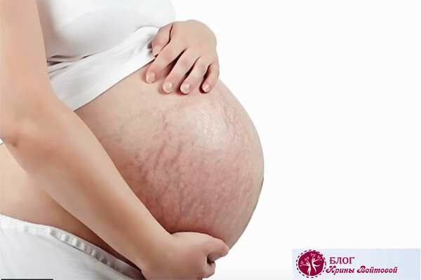 Борьба с растяжками на животе после родов: проверенные домашние методы